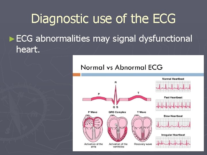 Diagnostic use of the ECG ► ECG abnormalities may signal dysfunctional heart. 