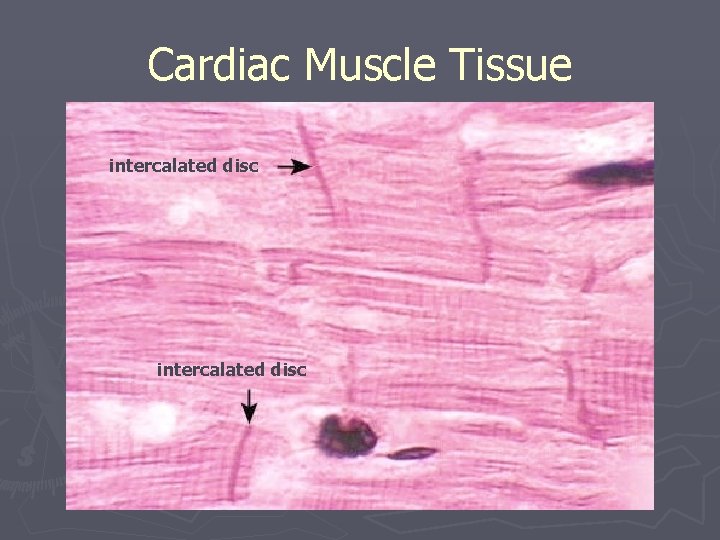Cardiac Muscle Tissue intercalated disc 