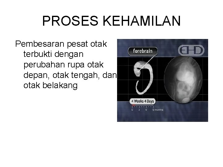 PROSES KEHAMILAN Pembesaran pesat otak terbukti dengan perubahan rupa otak depan, otak tengah, dan