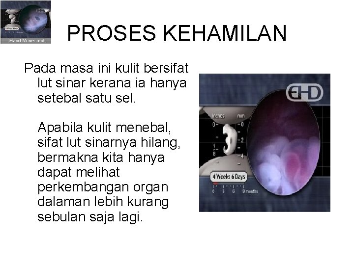 PROSES KEHAMILAN Pada masa ini kulit bersifat lut sinar kerana ia hanya setebal satu