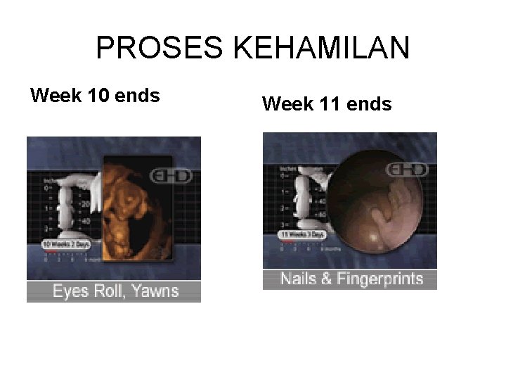PROSES KEHAMILAN Week 10 ends Week 11 ends 
