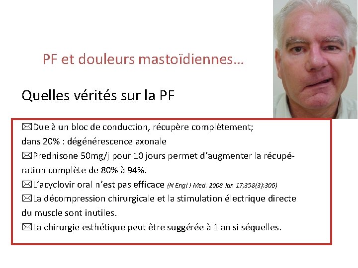 PF et douleurs mastoïdiennes… Quelles vérités sur la PF Due à un bloc de