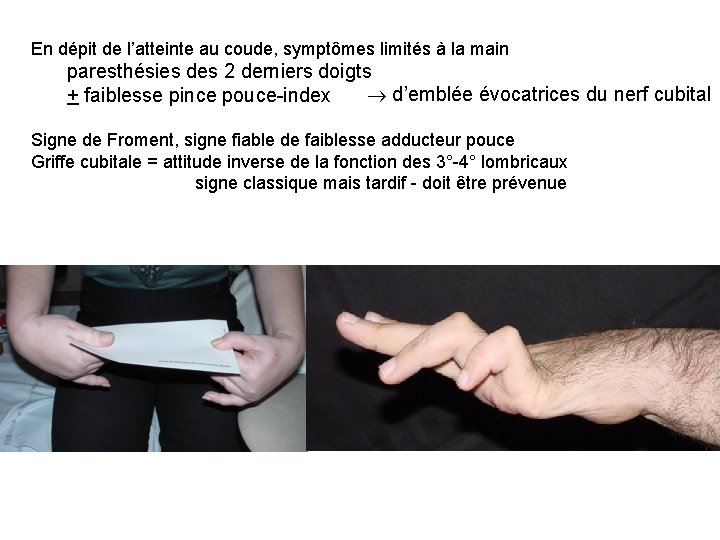 En dépit de l’atteinte au coude, symptômes limités à la main paresthésies des 2