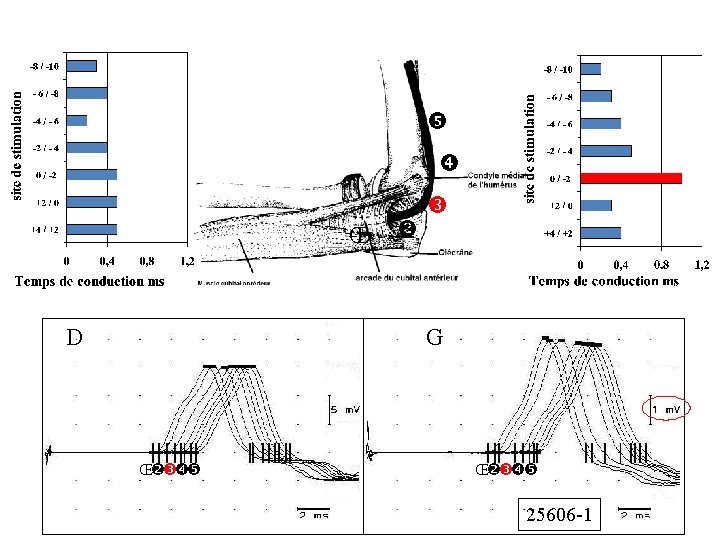  Œ D G Œ Œ 25606 -1 
