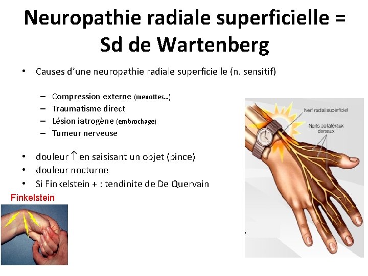 Neuropathie radiale superficielle = Sd de Wartenberg • Causes d’une neuropathie radiale superficielle (n.