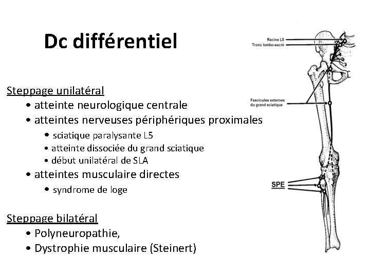 Dc différentiel Steppage unilatéral • atteinte neurologique centrale • atteintes nerveuses périphériques proximales •