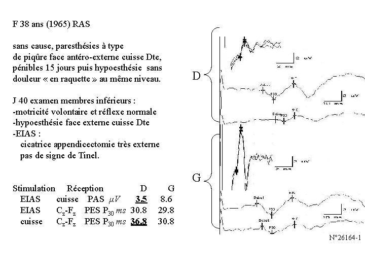 F 38 ans (1965) RAS sans cause, paresthésies à type de piqûre face antéro-externe