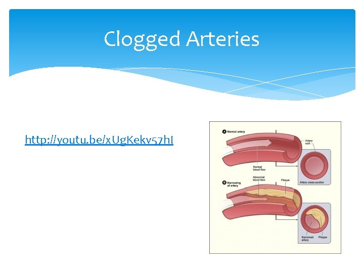 Clogged Arteries http: //youtu. be/x. Ug. Kekv 57 h. I 