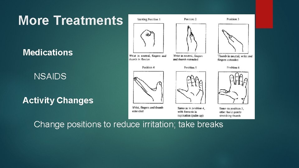 More Treatments Medications NSAIDS Activity Changes Change positions to reduce irritation; take breaks 