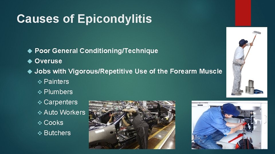 Causes of Epicondylitis Poor General Conditioning/Technique Overuse Jobs with Vigorous/Repetitive Use of the Forearm