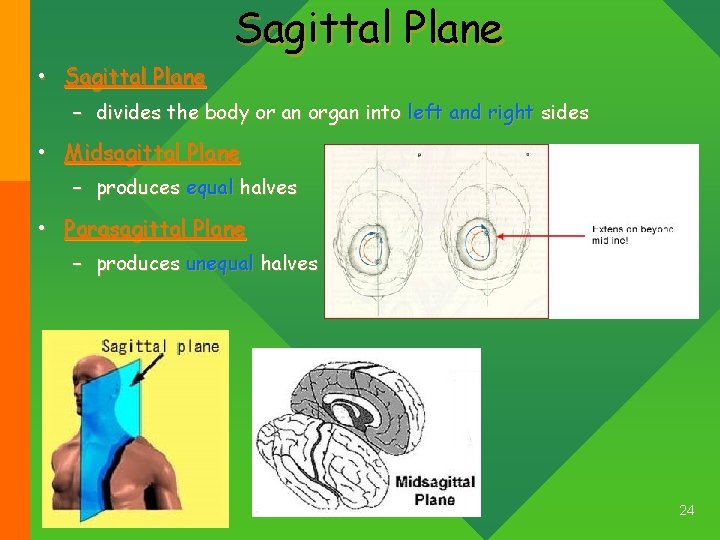Sagittal Plane • Sagittal Plane – divides the body or an organ into left