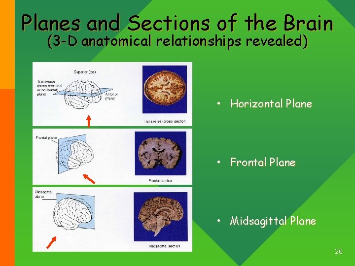 Planes and Sections of the Brain (3 -D anatomical relationships revealed) • Horizontal Plane