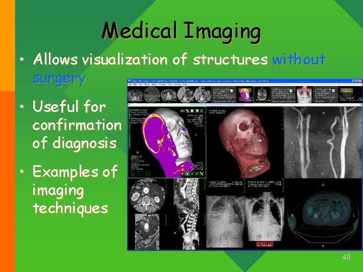 Medical Imaging • Allows visualization of structures without surgery • Useful for confirmation of