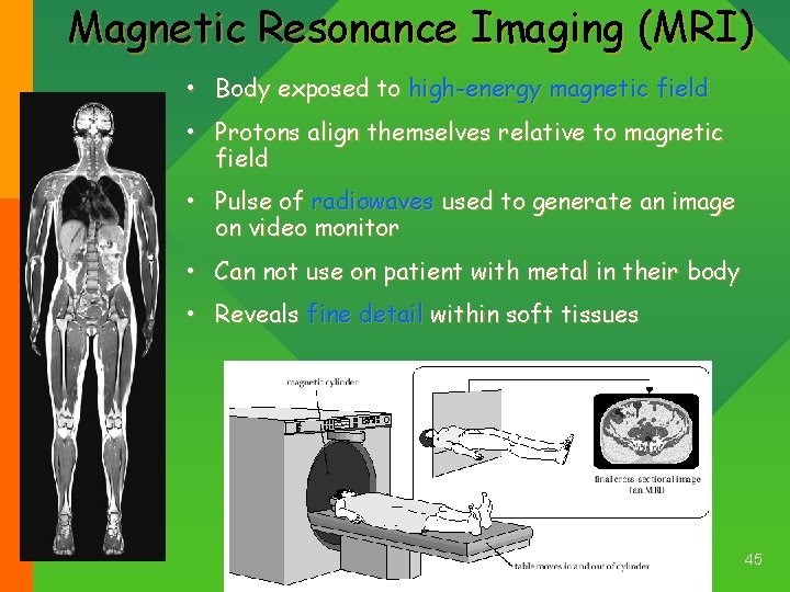 Magnetic Resonance Imaging (MRI) • Body exposed to high-energy magnetic field • Protons align