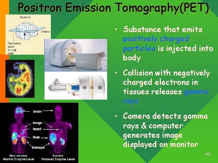 Positron Emission Tomography(PET) • Substance that emits positively charged particles is injected into body