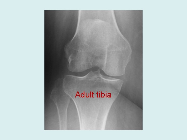 Adult tibia 