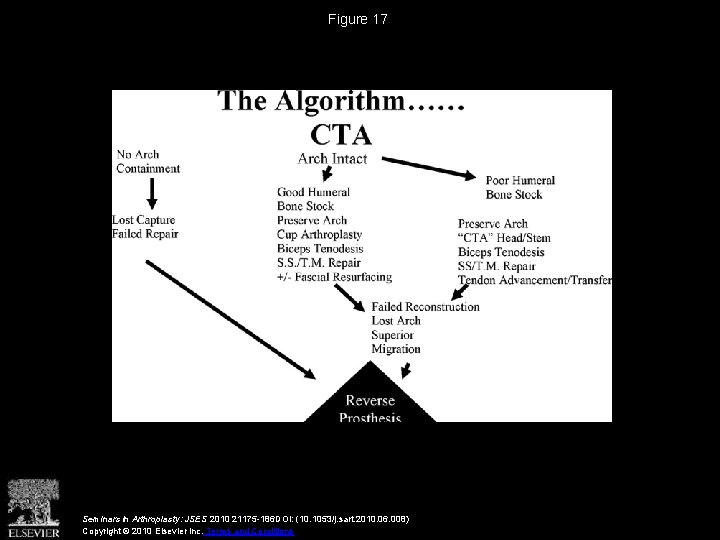 Figure 17 Seminars in Arthroplasty: JSES 2010 21175 -186 DOI: (10. 1053/j. sart. 2010.