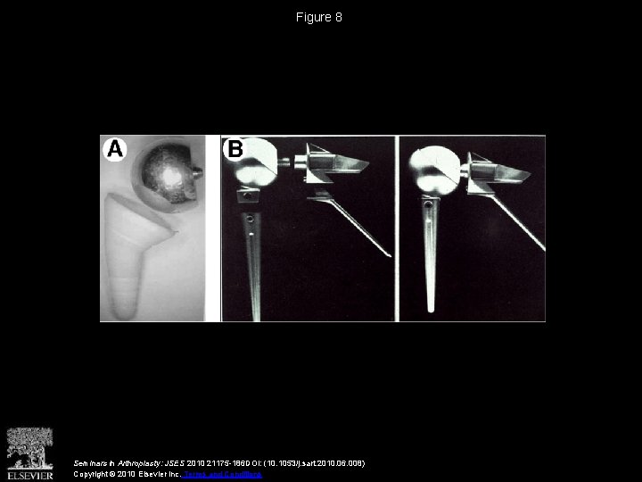 Figure 8 Seminars in Arthroplasty: JSES 2010 21175 -186 DOI: (10. 1053/j. sart. 2010.