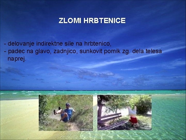 ZLOMI HRBTENICE - delovanje indirektne sile na hrbtenico, - padec na glavo, zadnjico, sunkovit