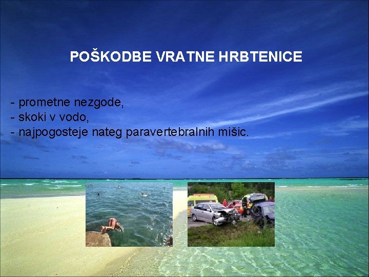 POŠKODBE VRATNE HRBTENICE - prometne nezgode, - skoki v vodo, - najpogosteje nateg paravertebralnih