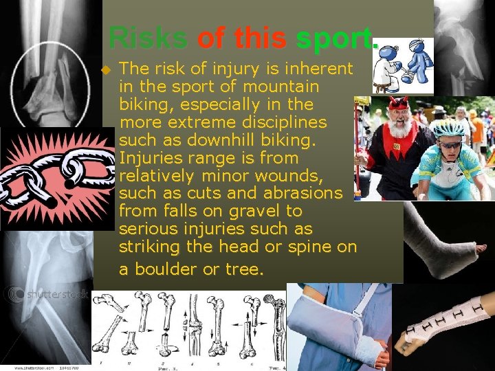 Risks of this sport. The risk of injury is inherent in the sport of