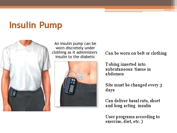 Insulin Pump Can be worn on belt or clothing Tubing inserted into subcutaneous tissue