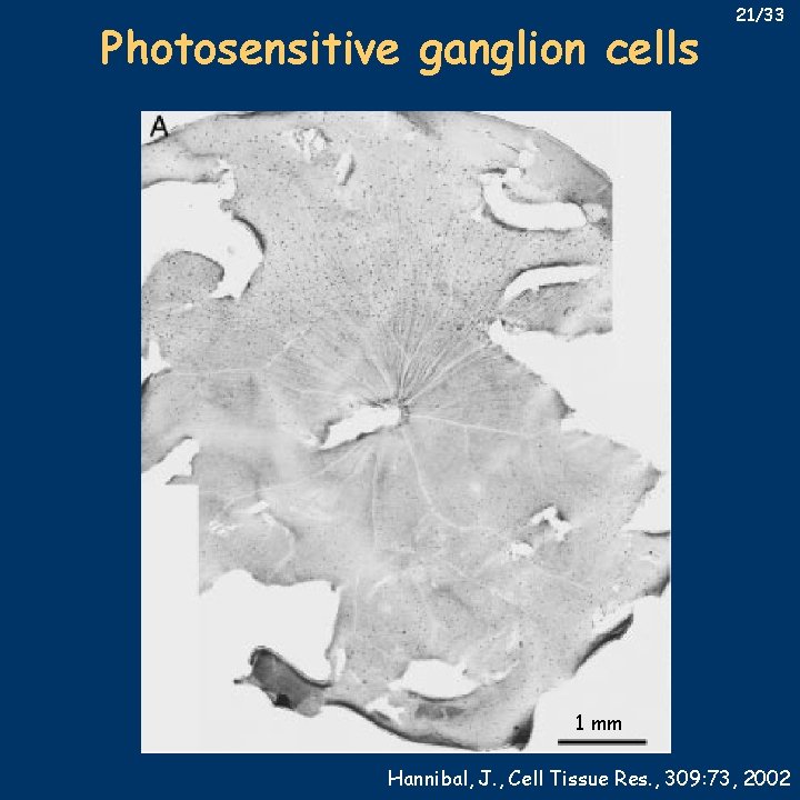 Photosensitive ganglion cells 21/33 1 mm Hannibal, J. , Cell Tissue Res. , 309: