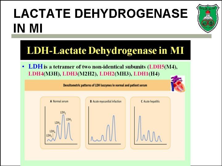 LACTATE DEHYDROGENASE IN MI 