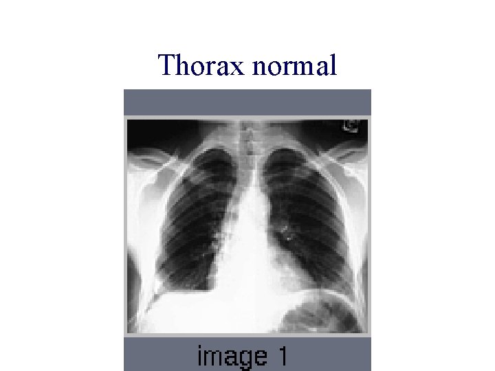 Thorax normal 