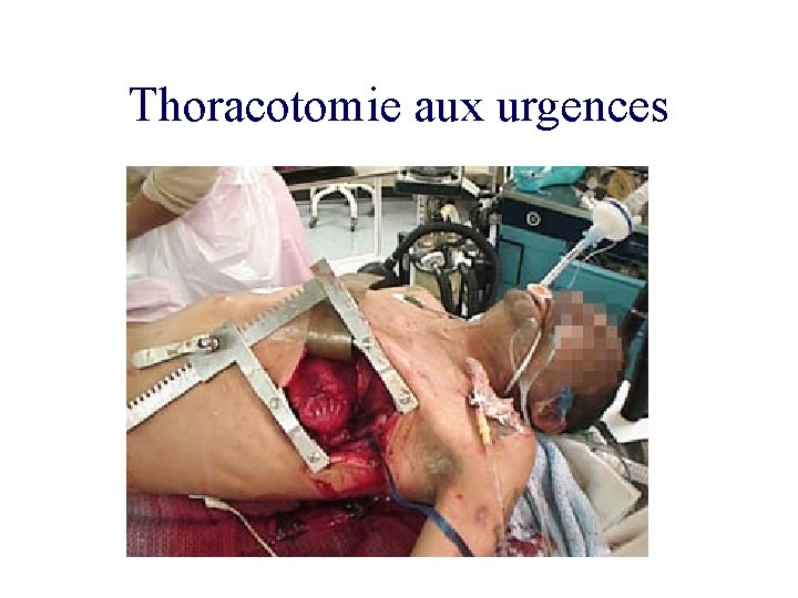Thoracotomie aux urgences 