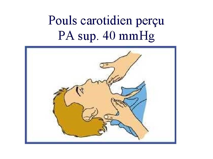 Pouls carotidien perçu PA sup. 40 mm. Hg 