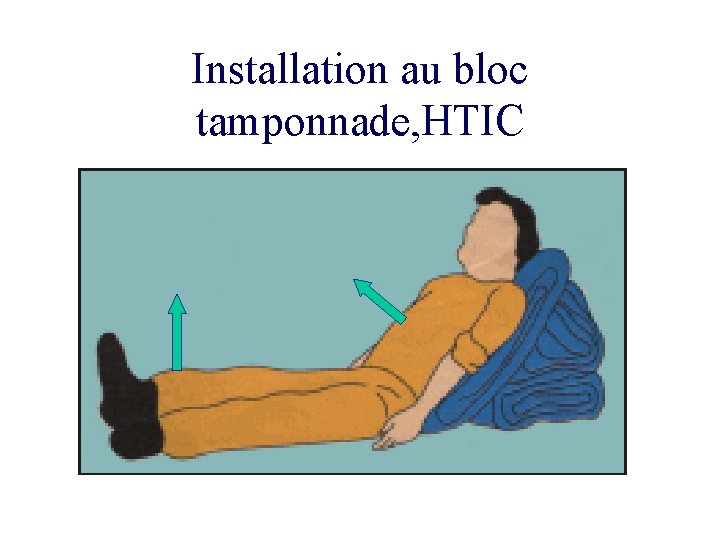 Installation au bloc tamponnade, HTIC 