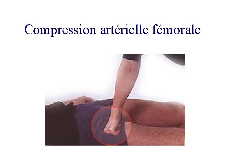 Compression artérielle fémorale 