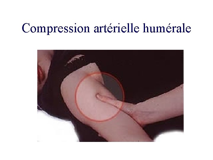 Compression artérielle humérale 