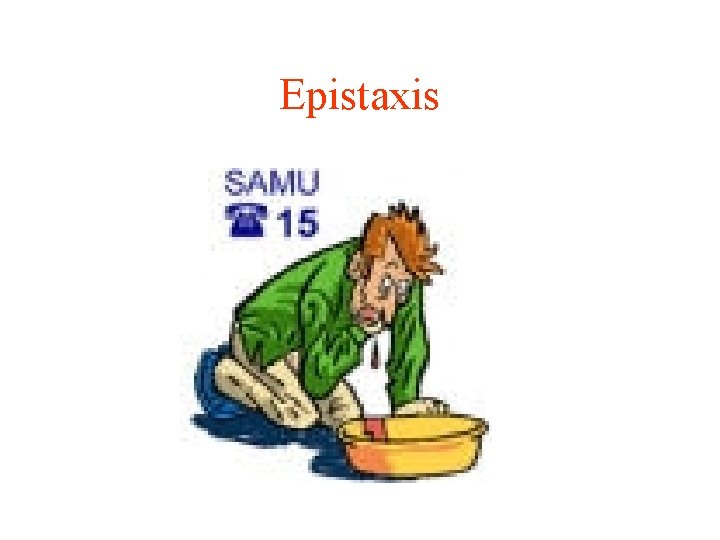 Epistaxis 