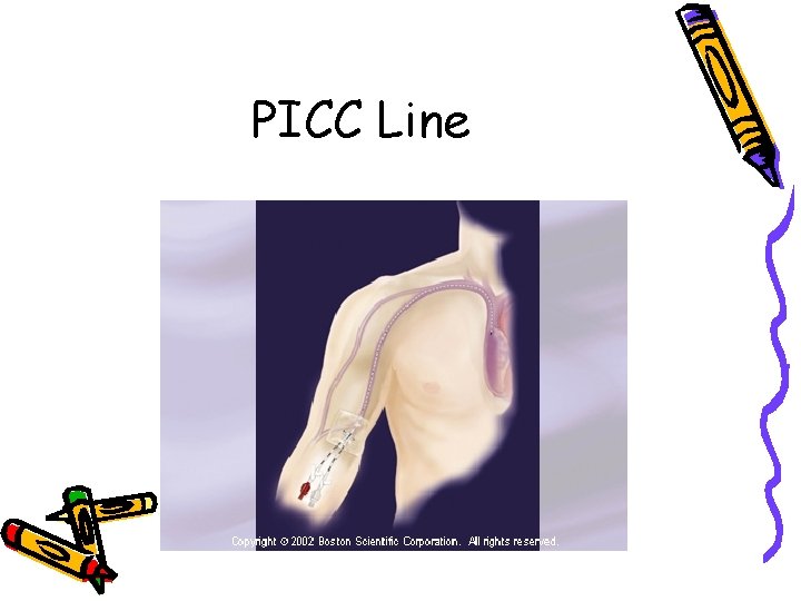 PICC Line 