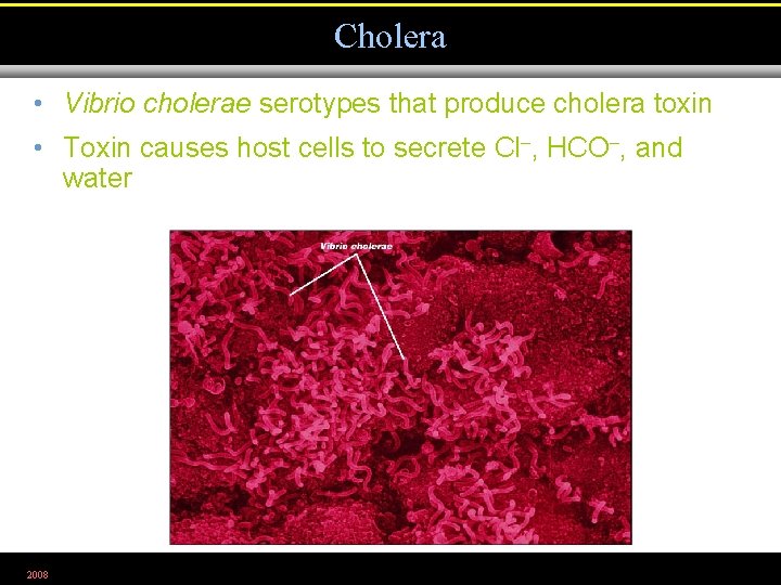 Cholera • Vibrio cholerae serotypes that produce cholera toxin • Toxin causes host cells