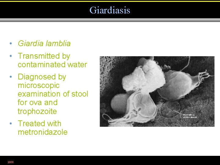 Giardiasis • Giardia lamblia • Transmitted by contaminated water • Diagnosed by microscopic examination