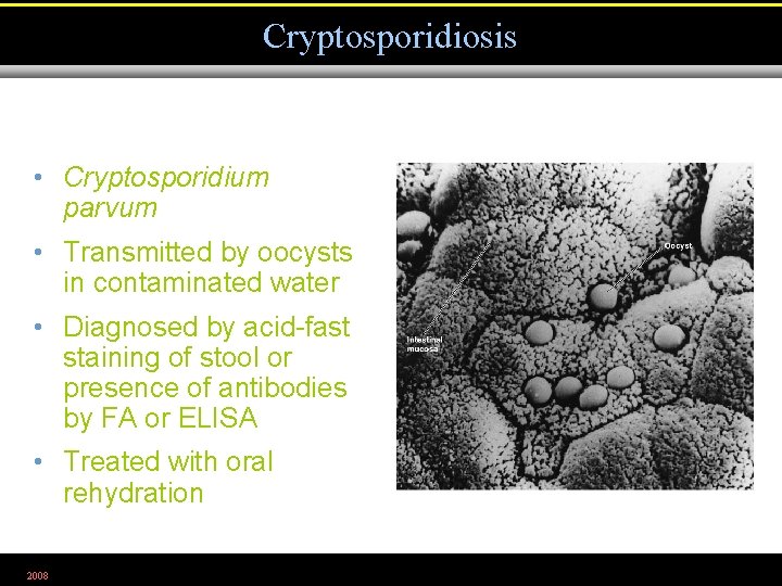 Cryptosporidiosis • Cryptosporidium parvum • Transmitted by oocysts in contaminated water • Diagnosed by