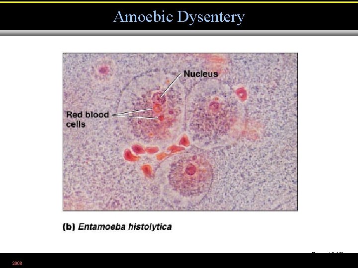 Amoebic Dysentery Figure 12. 18 b 2008 