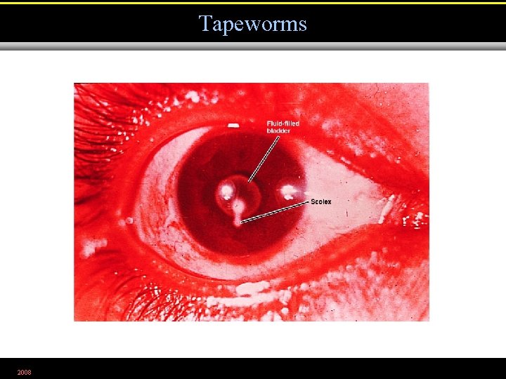 Tapeworms 2008 Figure 25. 22 