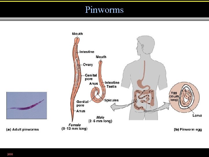 Pinworms 2008 Figure 12. 29 