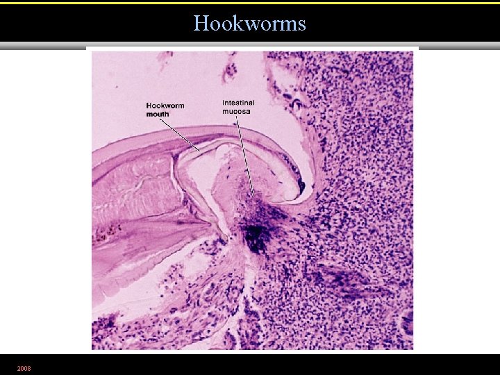 Hookworms 2008 Figure 25. 24 