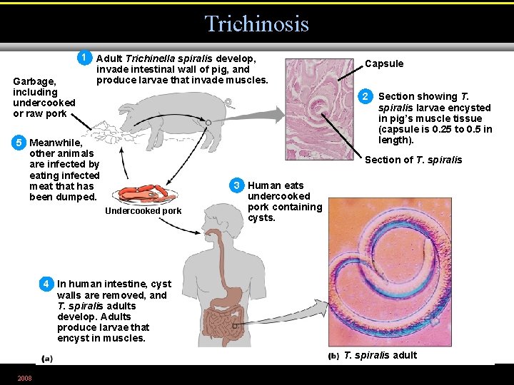 Trichinosis Garbage, including undercooked or raw pork 1 Adult Trichinella spiralis develop, invade intestinal