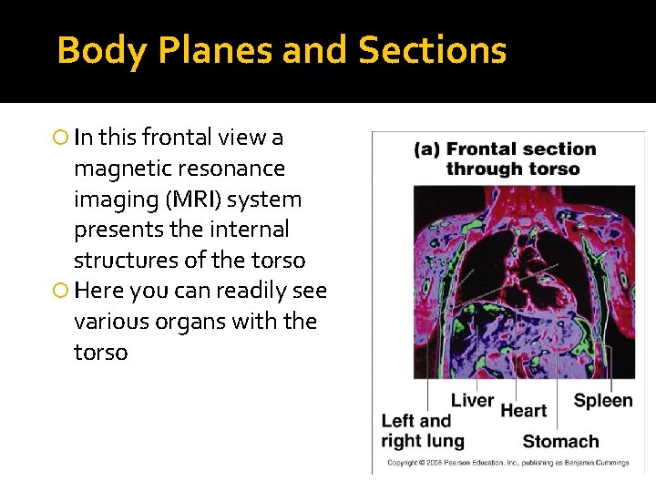 Body Planes and Sections In this frontal view a magnetic resonance imaging (MRI) system
