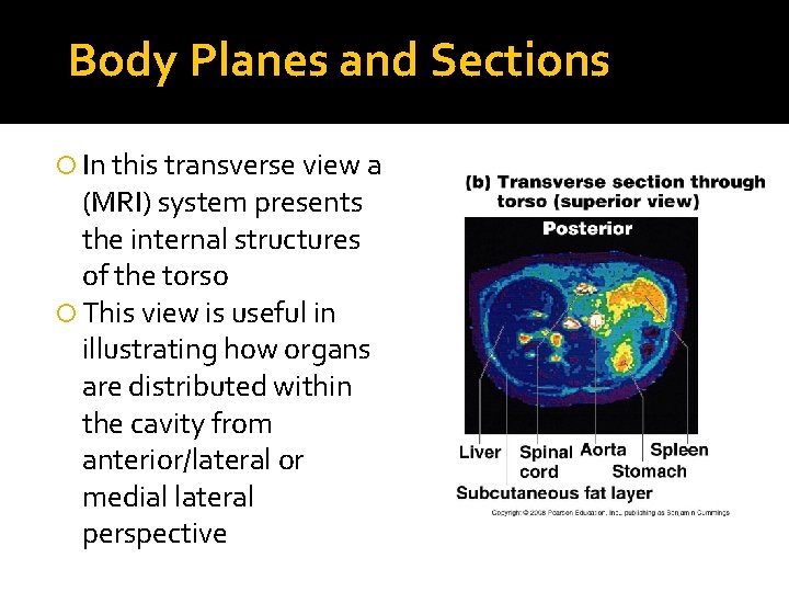 Body Planes and Sections In this transverse view a (MRI) system presents the internal