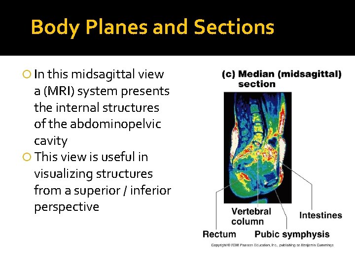 Body Planes and Sections In this midsagittal view a (MRI) system presents the internal