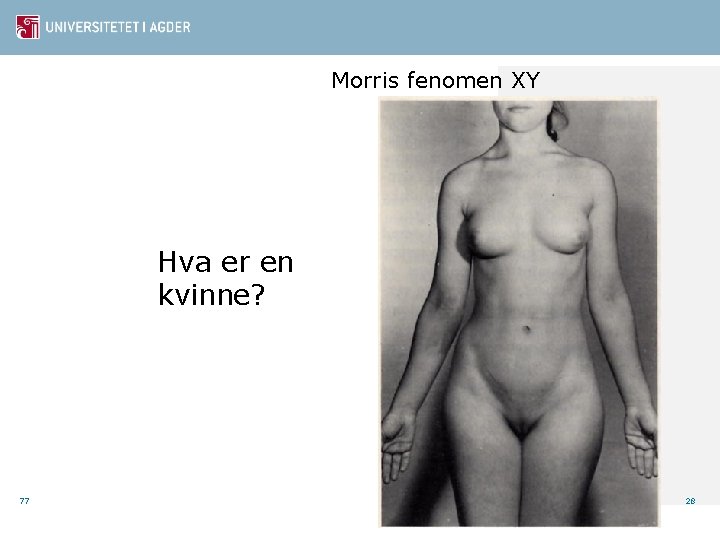 Morris fenomen XY Hva er en kvinne? 77 28 