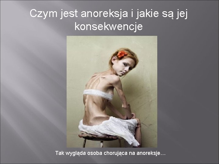 Czym jest anoreksja i jakie są jej konsekwencje Tak wygląda osoba chorująca na anoreksje…