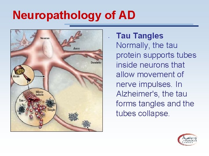 Neuropathology of AD • Tau Tangles Normally, the tau protein supports tubes inside neurons